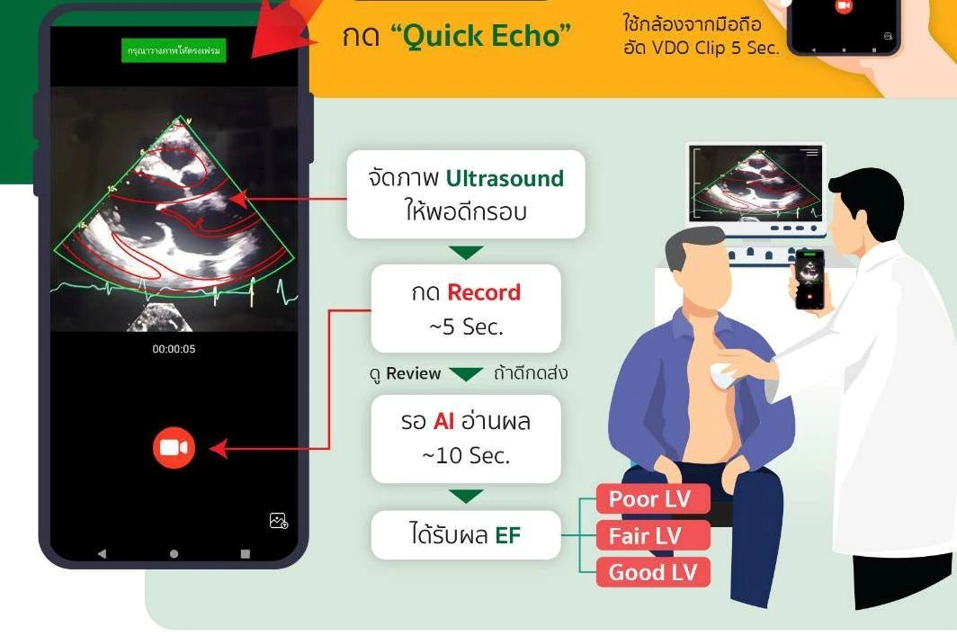 ภาพคู่มือพร้อมหน้าจอบันทึกวิดีโอ EasyEF: จัดภาพให้พอดีกรอบ บันทึก ตรวจคลิป แล้วส่งวิเคราะห์