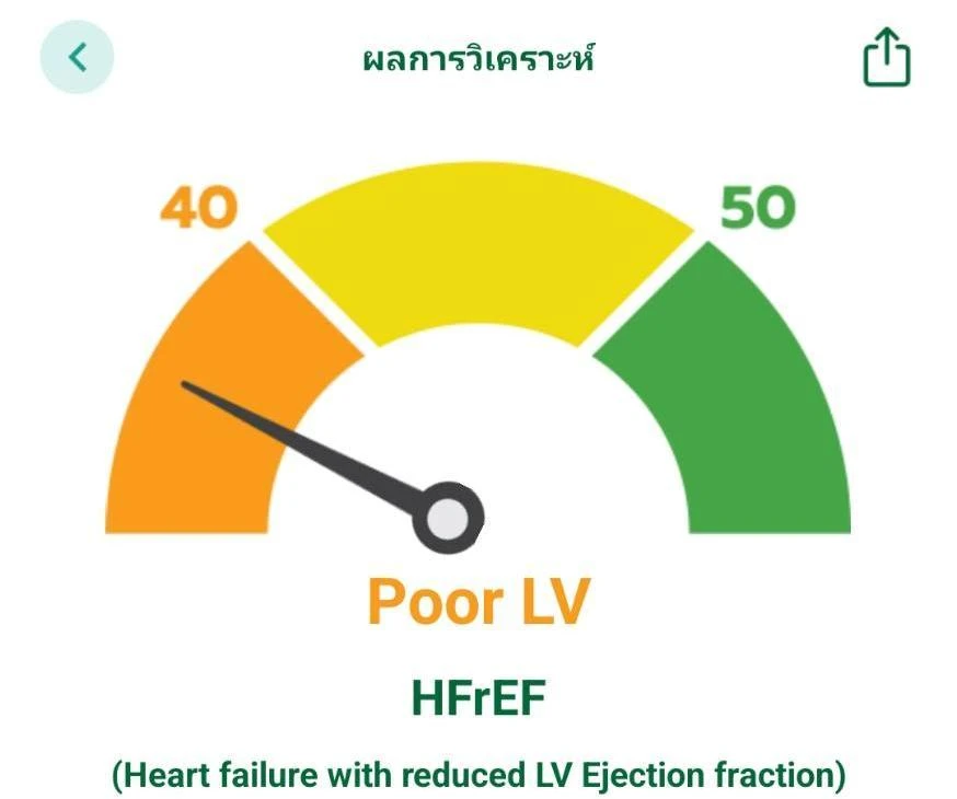 ตัวอย่างหน้าจอผลวิเคราะห์ของ EasyEF รุ่นที่นำเสนอ แสดงกลุ่ม Poor LV